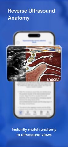 NYSORA Nerve Blocks для iOS — скриншот 5